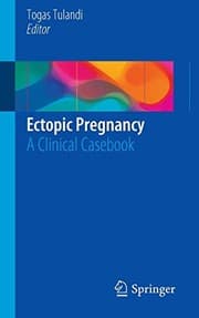 Tapa de Ectopic Pregnancy