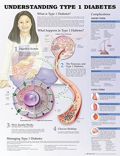 Tapa de Understanding Type 1 Diabetes Anatomical Chart