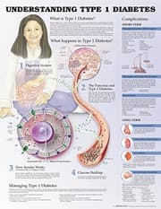 Tapa de Understanding Type 1 Diabetes Anatomical Chart