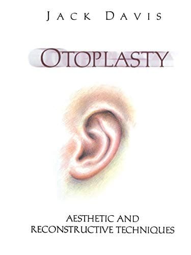 Tapa de Otoplasty