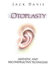 Tapa de Otoplasty