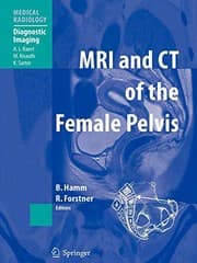 Tapa de MRI and CT of the Female Pelvis
