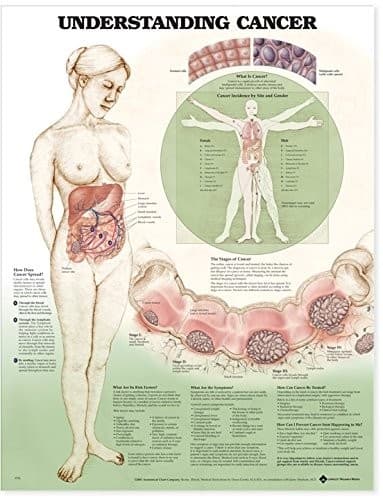 Tapa de Understanding Cancer Anatomical Chart