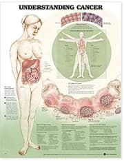 Tapa de Understanding Cancer Anatomical Chart