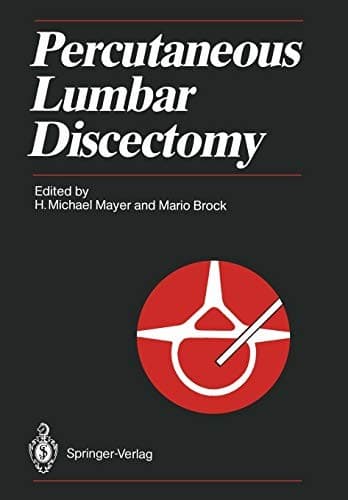Tapa de Percutaneous Lumbar Discectomy