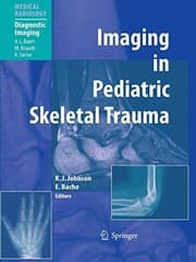 Tapa de Imaging in Pediatric Skeletal Trauma