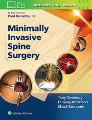 Tapa de Minimally Invasive Spine Surgery