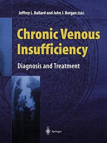 Tapa de Chronic Venous Insufficiency