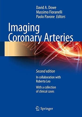 Tapa de Imaging Coronary Arteries