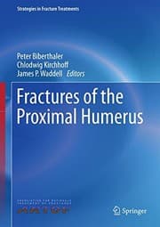 Tapa de Fractures of the Proximal Humerus