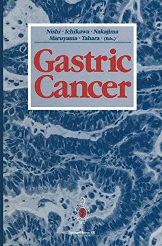 Tapa de Gastric Cancer