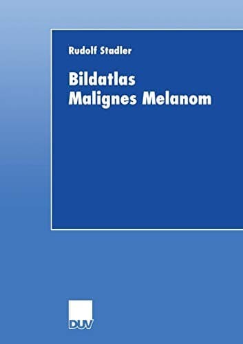Tapa de Bildatlas Malignes Melanom