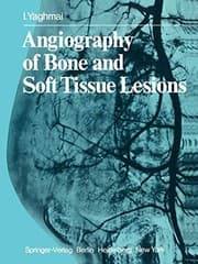 Tapa de Angiography of Bone and Soft Tissue Lesions