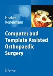 Tapa de Computer and Template Assisted Orthopedic Surgery