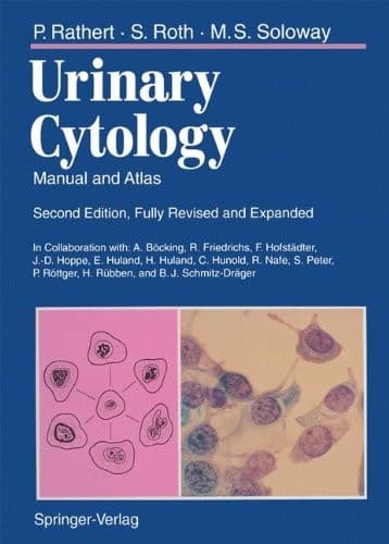 Tapa de Urinary Cytology