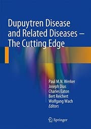 Tapa de Dupuytren Disease and Related Diseases - The Cutting Edge