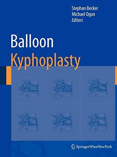 Tapa de Balloon Kyphoplasty