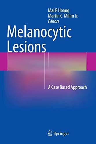 Tapa de Melanocytic Lesions