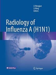 Tapa de Radiology of Influenza A