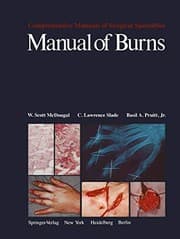 Tapa de Manual of Burns