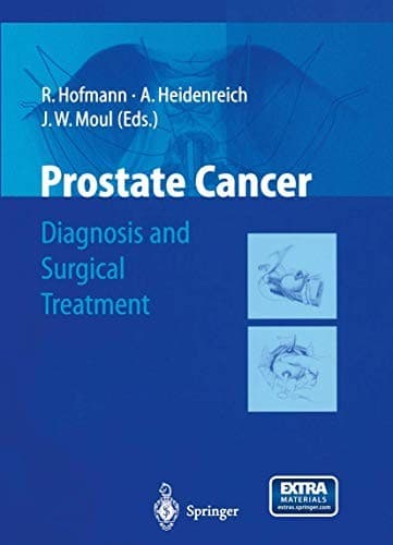 Tapa de Prostate Cancer