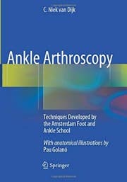 Tapa de Ankle Arthroscopy