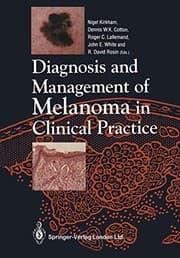 Tapa de Diagnosis and Management of Melanoma in Clinical Practice