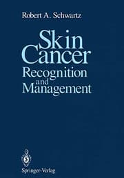 Tapa de Skin Cancer