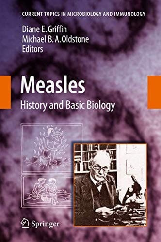 Tapa de Measles