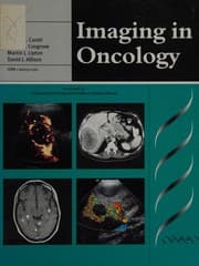 Tapa de Imaging in oncology