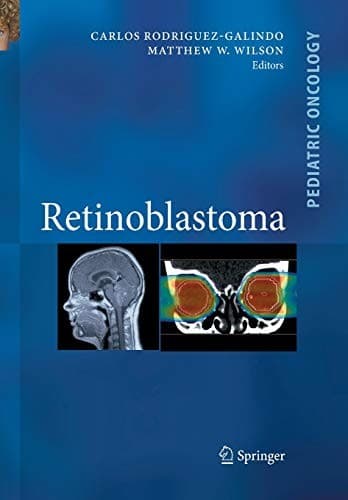 Tapa de Retinoblastoma