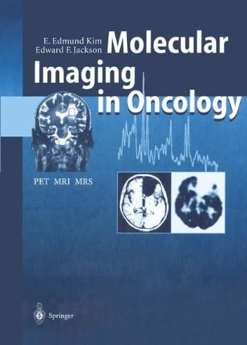 Tapa de Molecular Imaging in Oncology