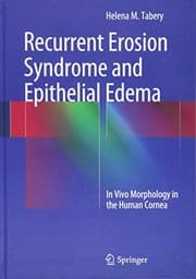 Tapa de Recurrent Erosion Syndrome and Epithelial Edema