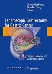 Tapa de Laparoscopic Gastrectomy for Gastric Cancer