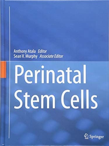 Tapa de Perinatal Stem Cells