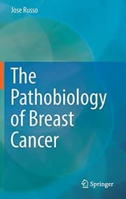 Tapa de The Pathobiology of Breast Cancer