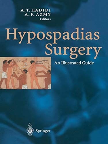 Tapa de Hypospadias Surgery