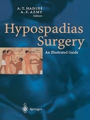 Tapa de Hypospadias Surgery
