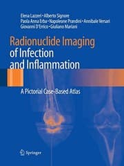 Tapa de Radionuclide Imaging of Infection and Inflammation