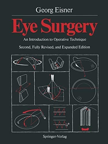 Tapa de Eye Surgery