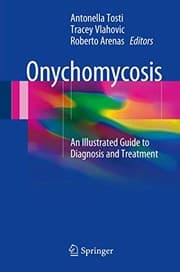 Tapa de Onychomycosis