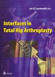 Tapa de Interfaces in Total Hip Arthroplasty