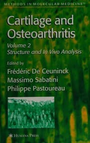 Tapa de Cartilage and osteoarthritis