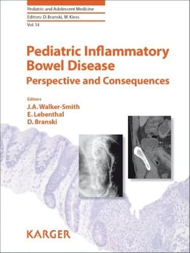 Tapa de Pediatric inflammatory bowel disease