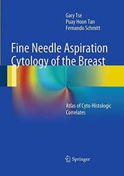 Tapa de Fine Needle Aspiration Cytology of the Breast