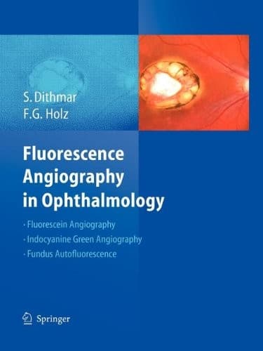 Tapa de Fluorescence Angiography in Ophthalmology
