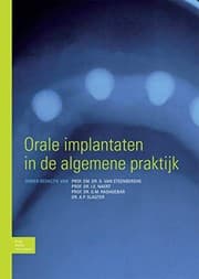 Tapa de Orale implantaten in de algemene praktijk