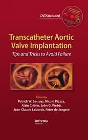 Tapa de Transcatheter aortic valve transplantation