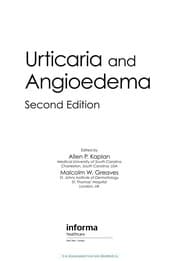 Tapa de Urticaria and angioedema