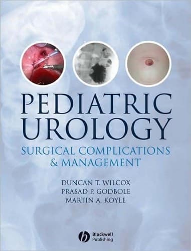 Tapa de Pediatric urology